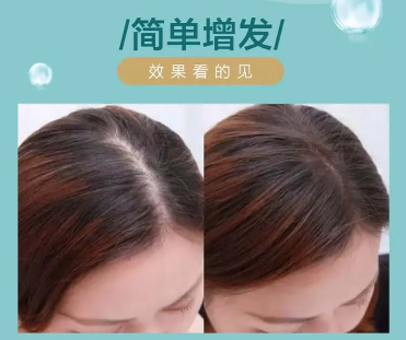 爆款案例 |運(yùn)營秘訣，揭秘伊奈絲增發(fā)的流量密碼